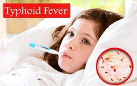 Typhoid Fever (टाइफाइड बुखार) का निदान